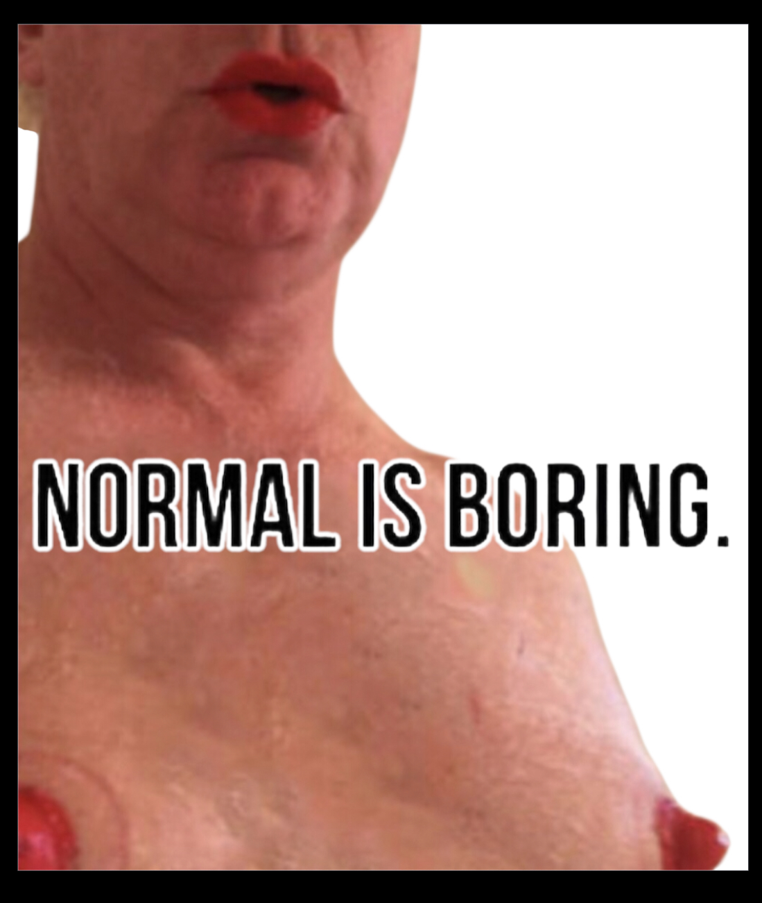Normal is boring.