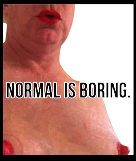 normal is boring