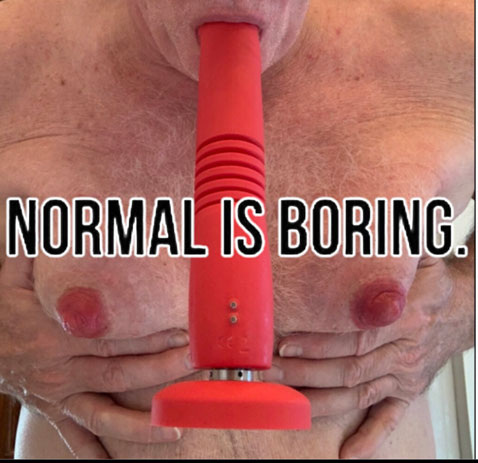 Normal is boring